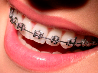 assets/images/new-gallery/orthodonty.png